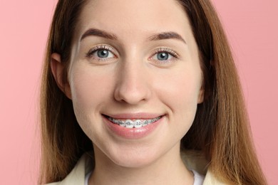 Photo of Portrait of smiling woman with dental braces on pink background, closeup