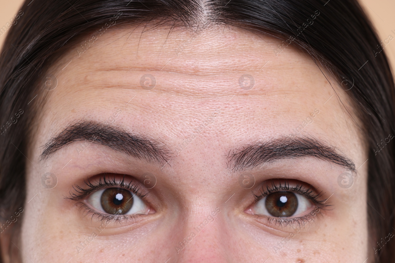 Photo of Closeup view of woman with wrinkles on her forehead