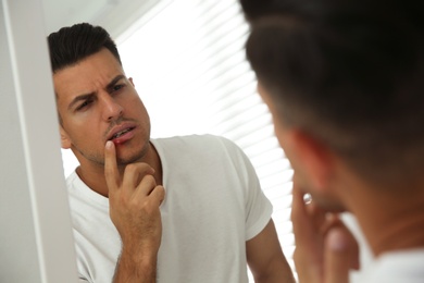 Photo of Man with herpes touching lips in front of mirror at home