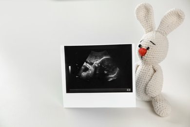 Photo of Ultrasound photo of baby and toy on white background