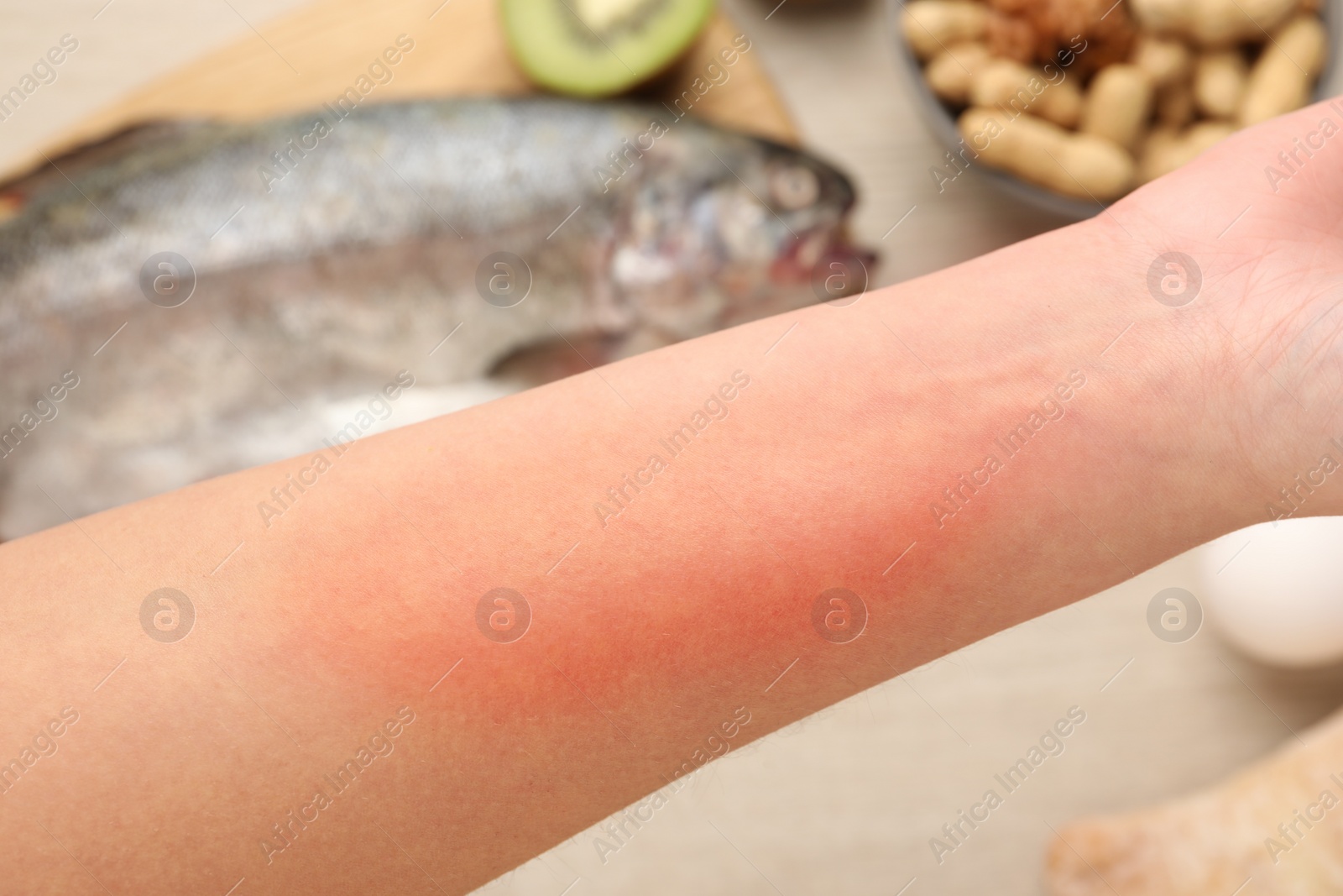 Photo of Food allergy. Woman holding hand over products on table, closeup