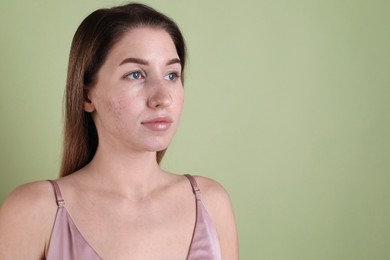 Young woman with acne problem on olive background. Space for text