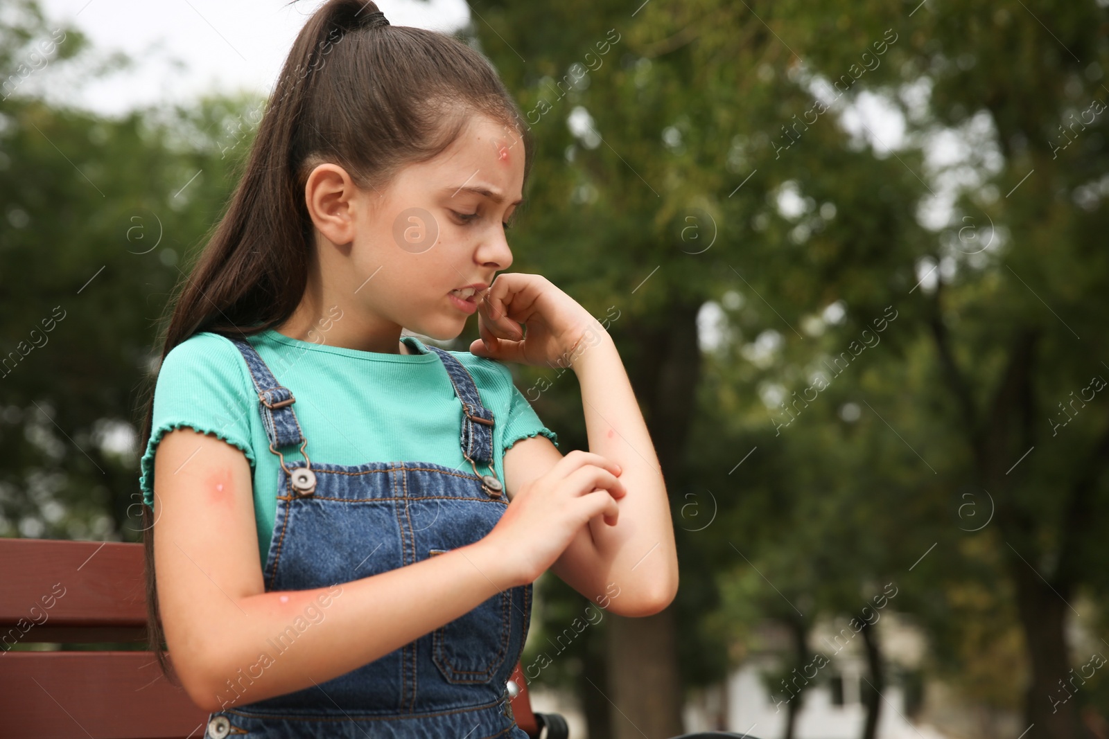 Photo of Girl scratching arm with insect bite in park