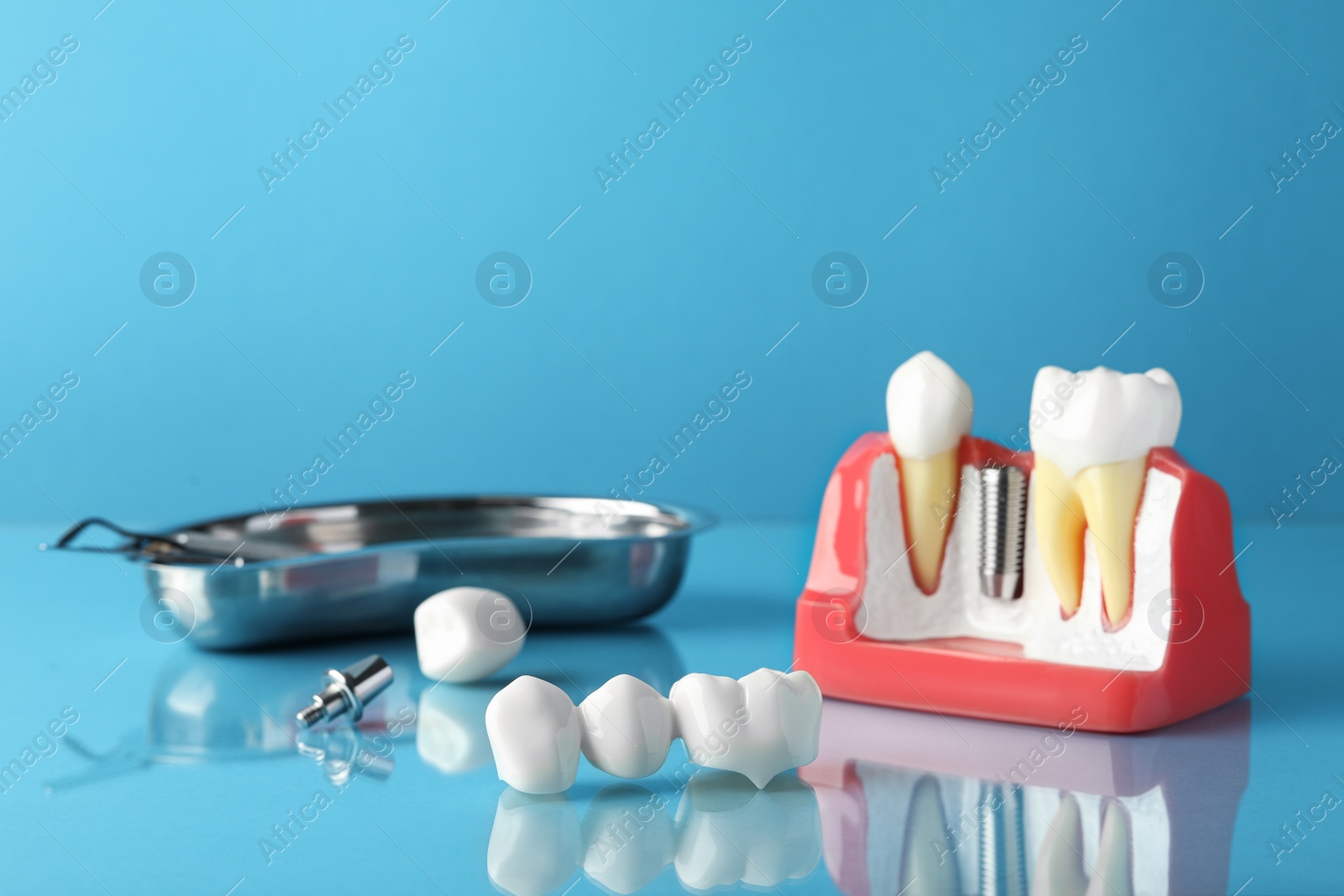 Photo of Dental bridge near educational model of gum with implant on light blue background. Space for text