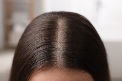 Woman with healthy hair on blurred background, closeup view