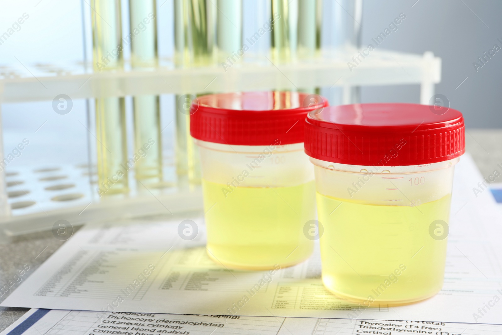 Photo of Containers with urine sample for analysis and test form on table in laboratory, closeup