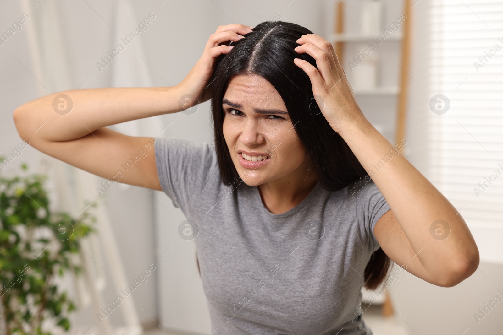 Photo of Emotional woman examining her hair and scalp in bathroom. Dandruff problem