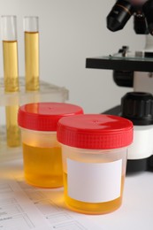 Photo of Containers with urine samples for analysis on table in laboratory