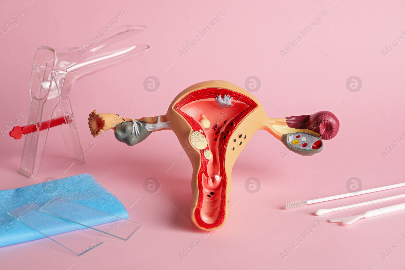 Photo of Gynecological examination kit and anatomical uterus model on pink background
