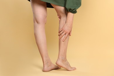 Closeup view of woman suffering from varicose veins on yellow background