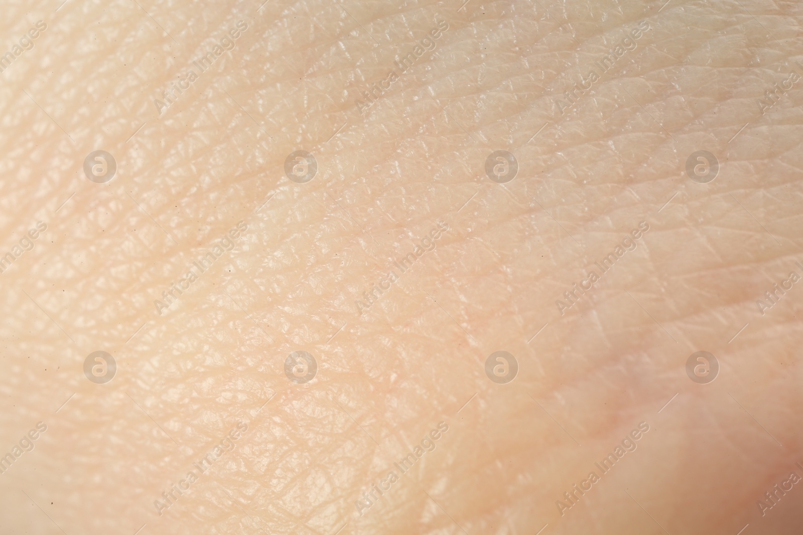 Photo of Texture of dry skin as background, macro view