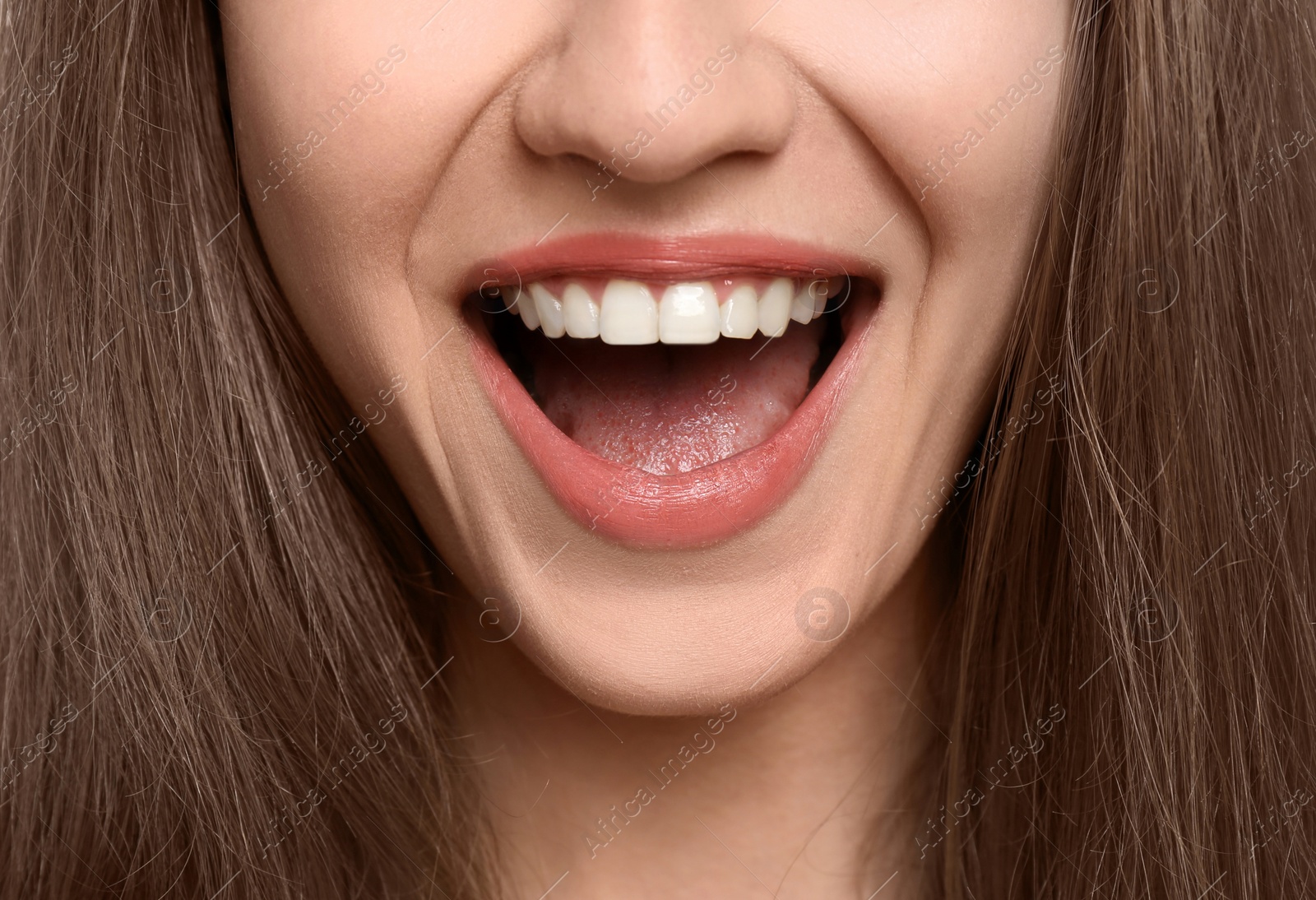 Photo of Young woman with beautiful smile, closeup. Teeth whitening