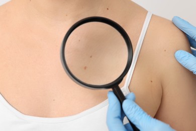 Photo of Dermatologist examining patient's birthmark with magnifying glass on beige background, closeup