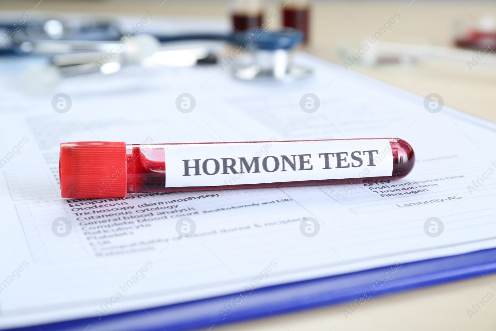 Photo of Hormone test. Sample tube with blood and laboratory form on table, closeup