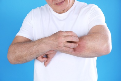 Senior man scratching forearm on color background, closeup. Allergy symptom