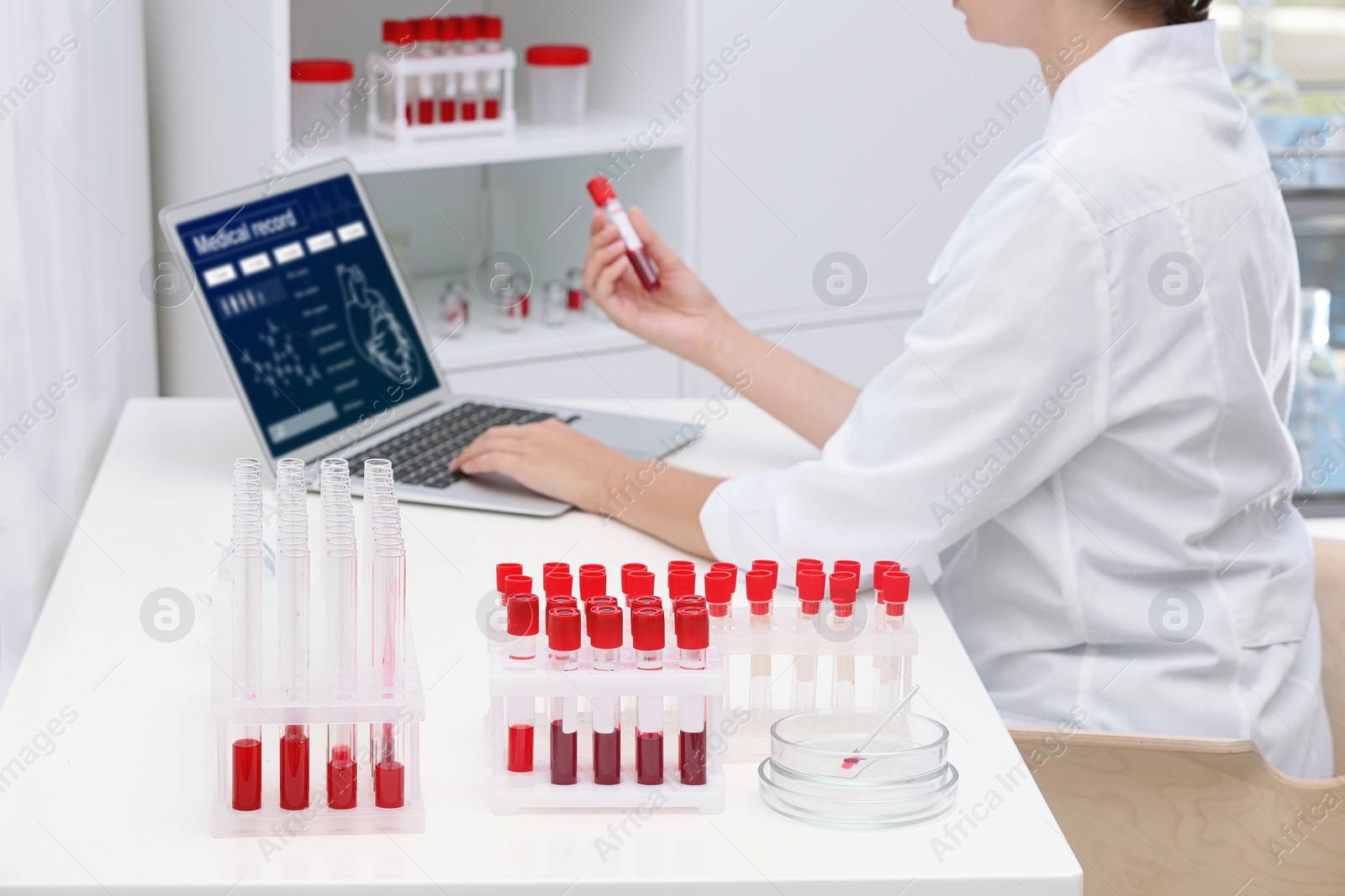 Photo of Test tubes with blood samples and scientist working on computer in laboratory