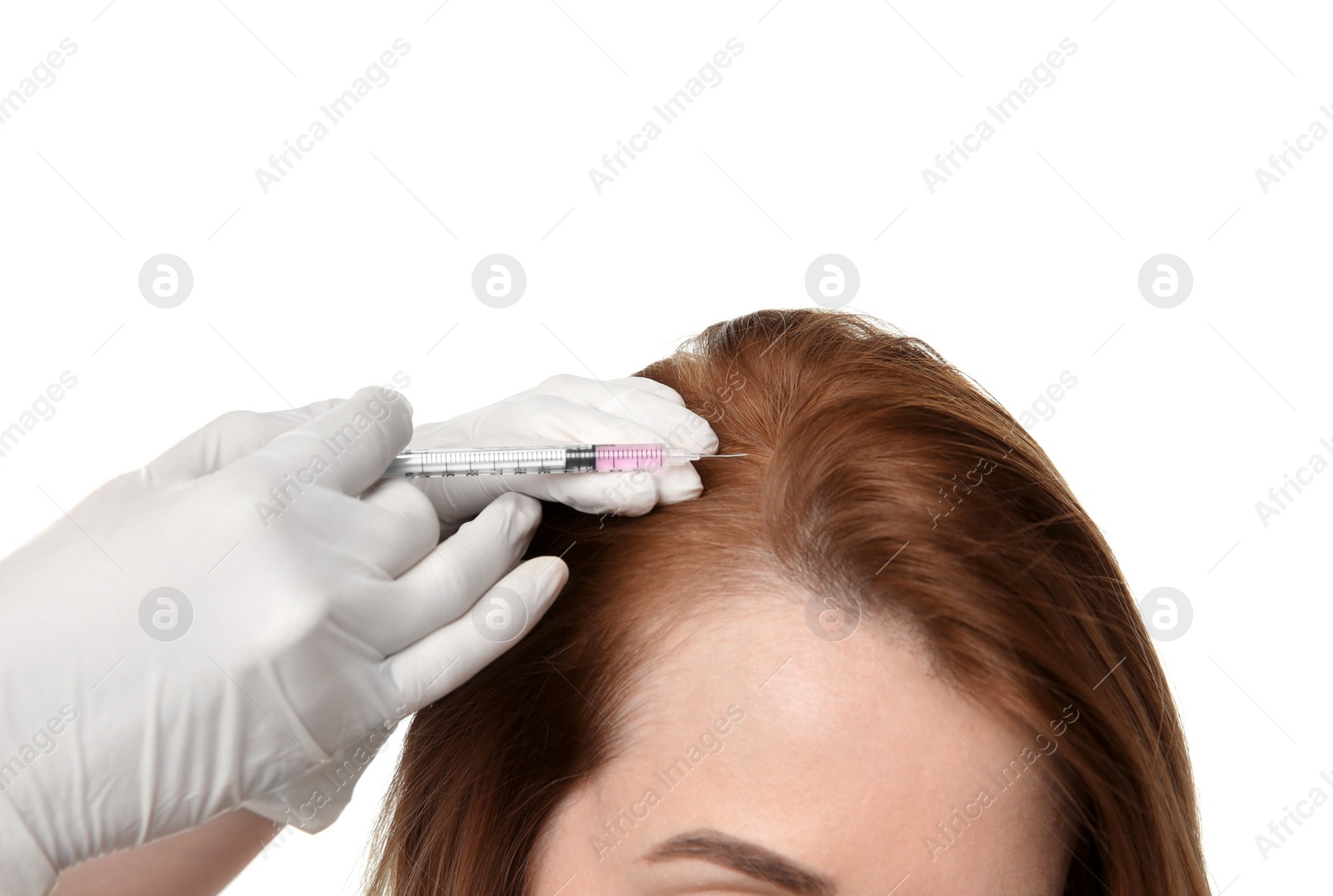 Photo of Young woman with hair loss problem receiving injection, on white background