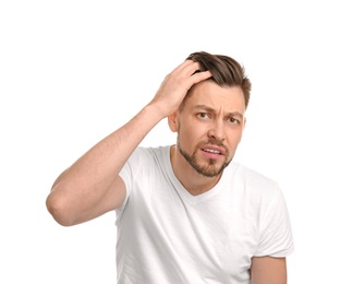 Photo of Young man with hair loss problem on white background