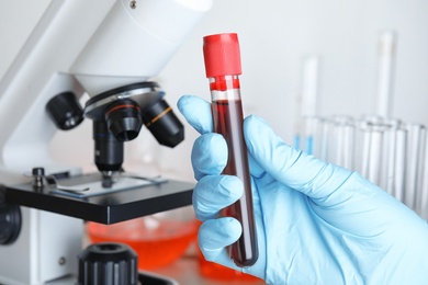 Scientist holding test tube with blood sample near microscope, closeup. Laboratory analysis