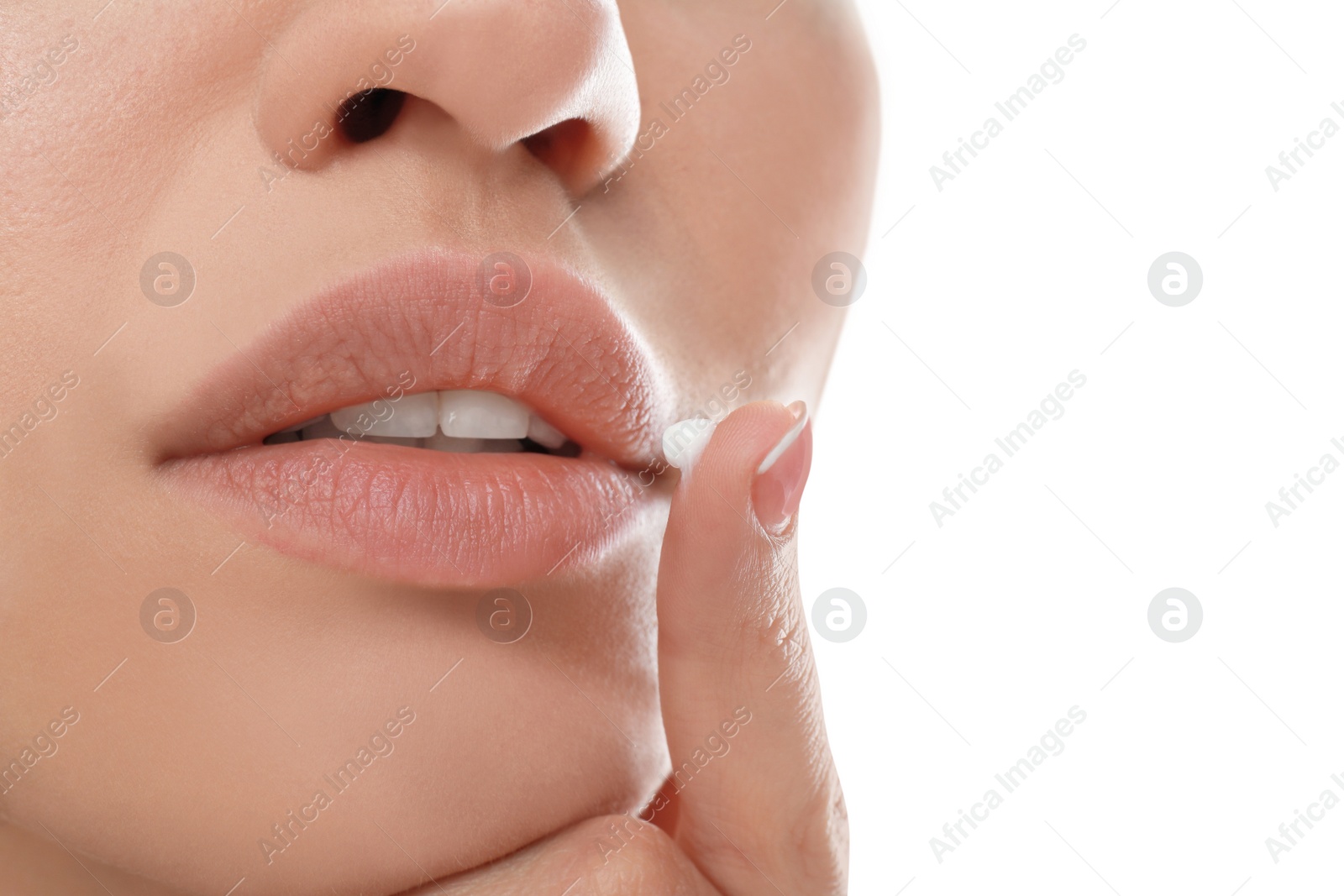 Image of Young woman with cold sore applying cream on lips against white background, closeup