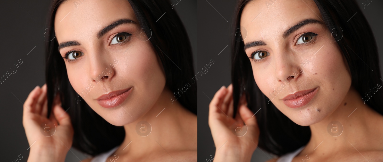 Image of Photo before and after retouch, collage. Portrait of beautiful young woman on dark background, banner design