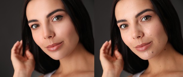 Photo before and after retouch, collage. Portrait of beautiful young woman on dark background, banner design