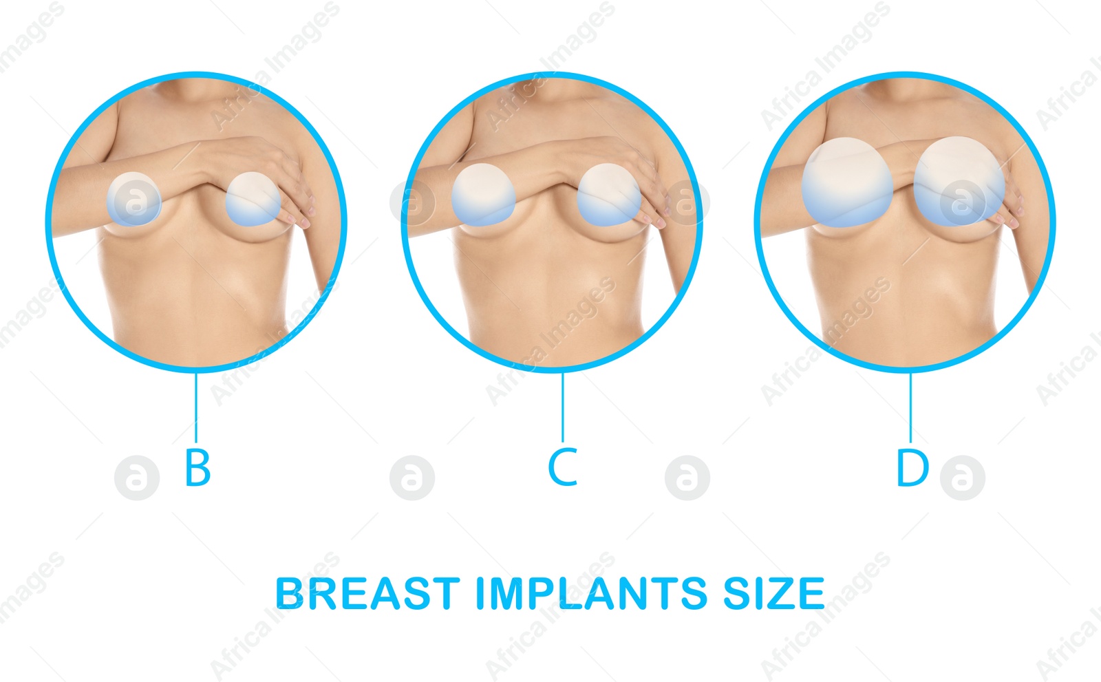 Image of Collage with photos of woman demonstrating different implant sizes for breast on white background, closeup. Banner design 