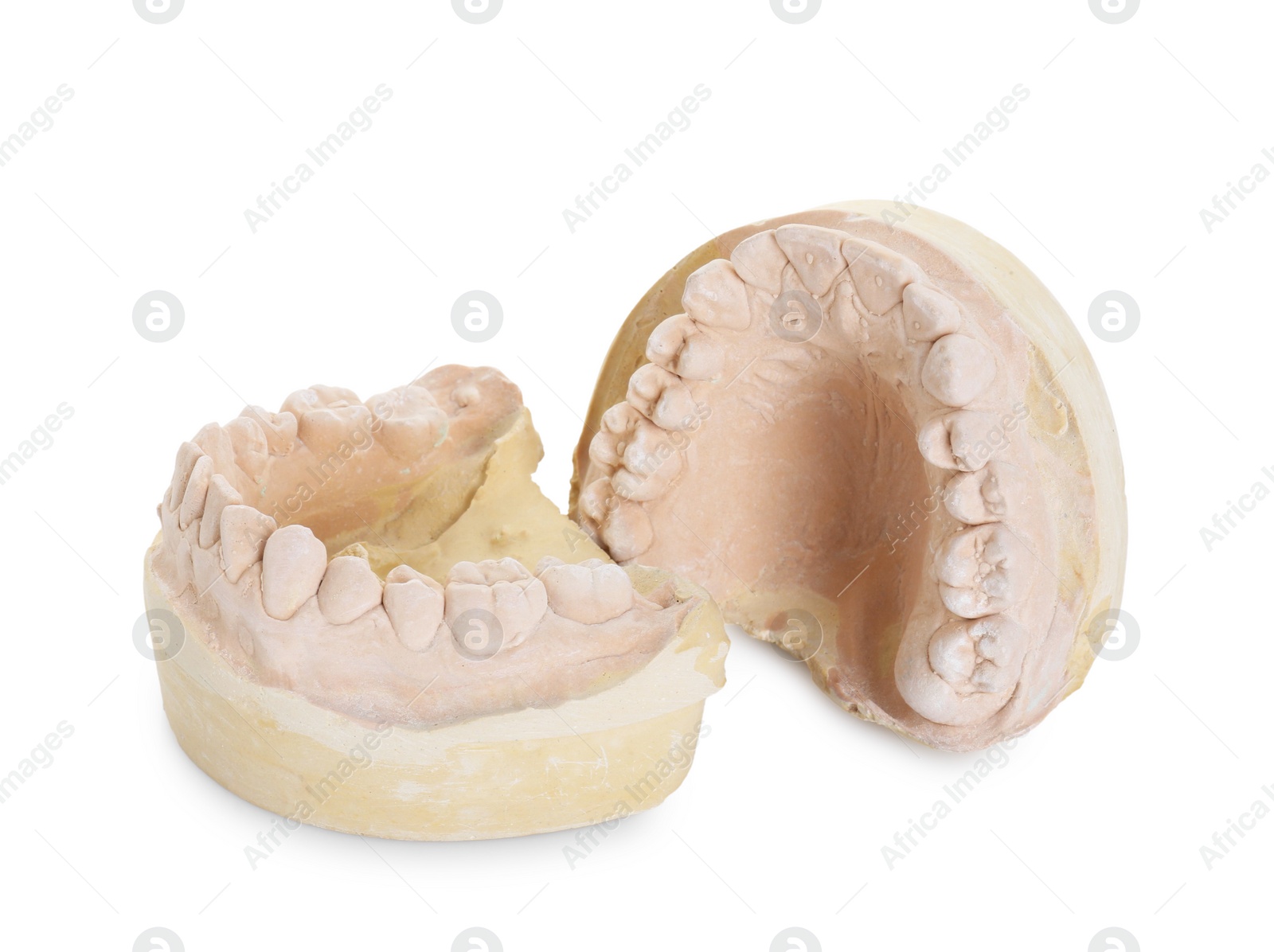 Photo of Dental model with jaws isolated on white. Cast of teeth