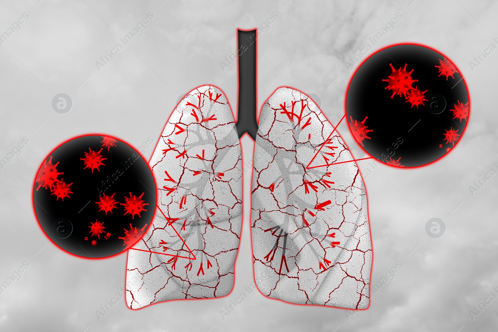 Illustration of  human lungs affected with disease on light background