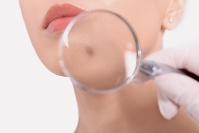 Dermatologist examining patient with magnifying glass in clinic, closeup view