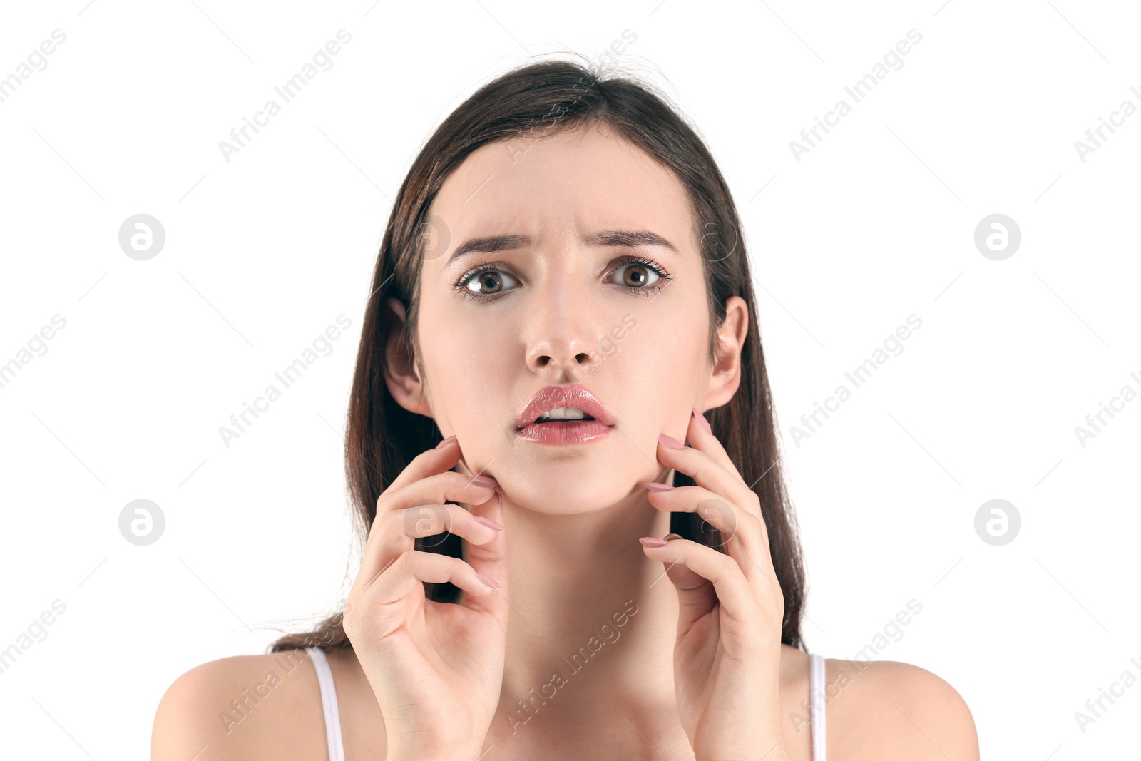 Photo of Teenage girl with acne problem against white background