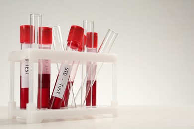 Photo of Tubes with blood samples in rack on white table, space for text. STD test