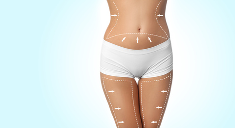Image of Slim young woman with marks on body for cosmetic surgery operation against light background, closeup. Banner design