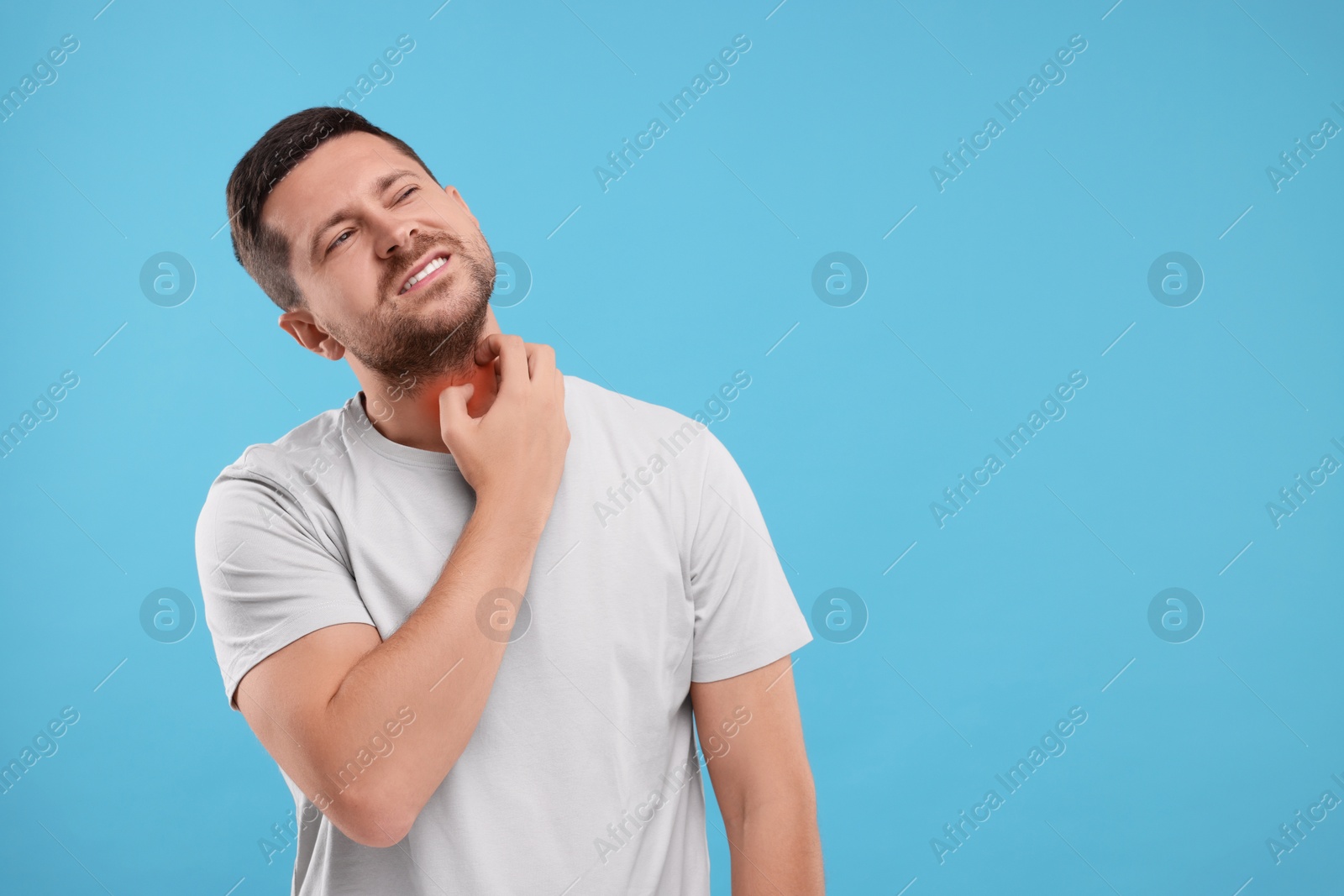 Photo of Allergy symptom. Man scratching his neck on light blue background. Space for text