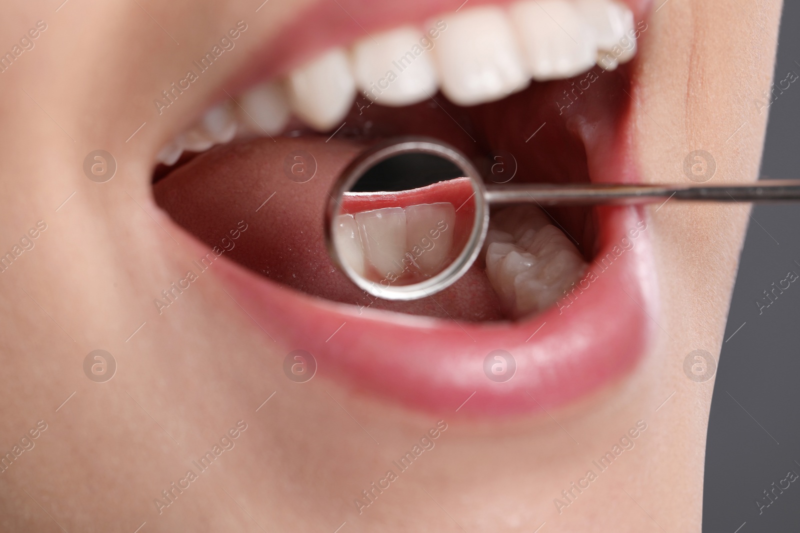 Photo of Examining woman's teeth with dentist's mirror, closeup