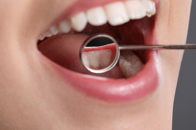 Photo of Examining woman's teeth with dentist's mirror, closeup