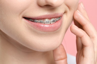 Smiling woman with dental braces on pink background, closeup