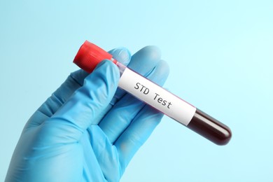 Photo of Scientist holding tube with blood sample and label STD Test on light blue background, closeup