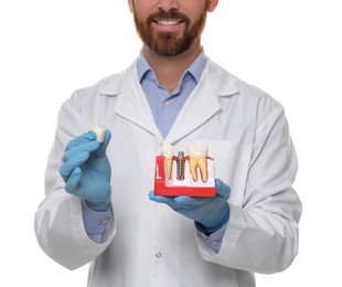 Dentist holding educational model of dental implant on white background, closeup