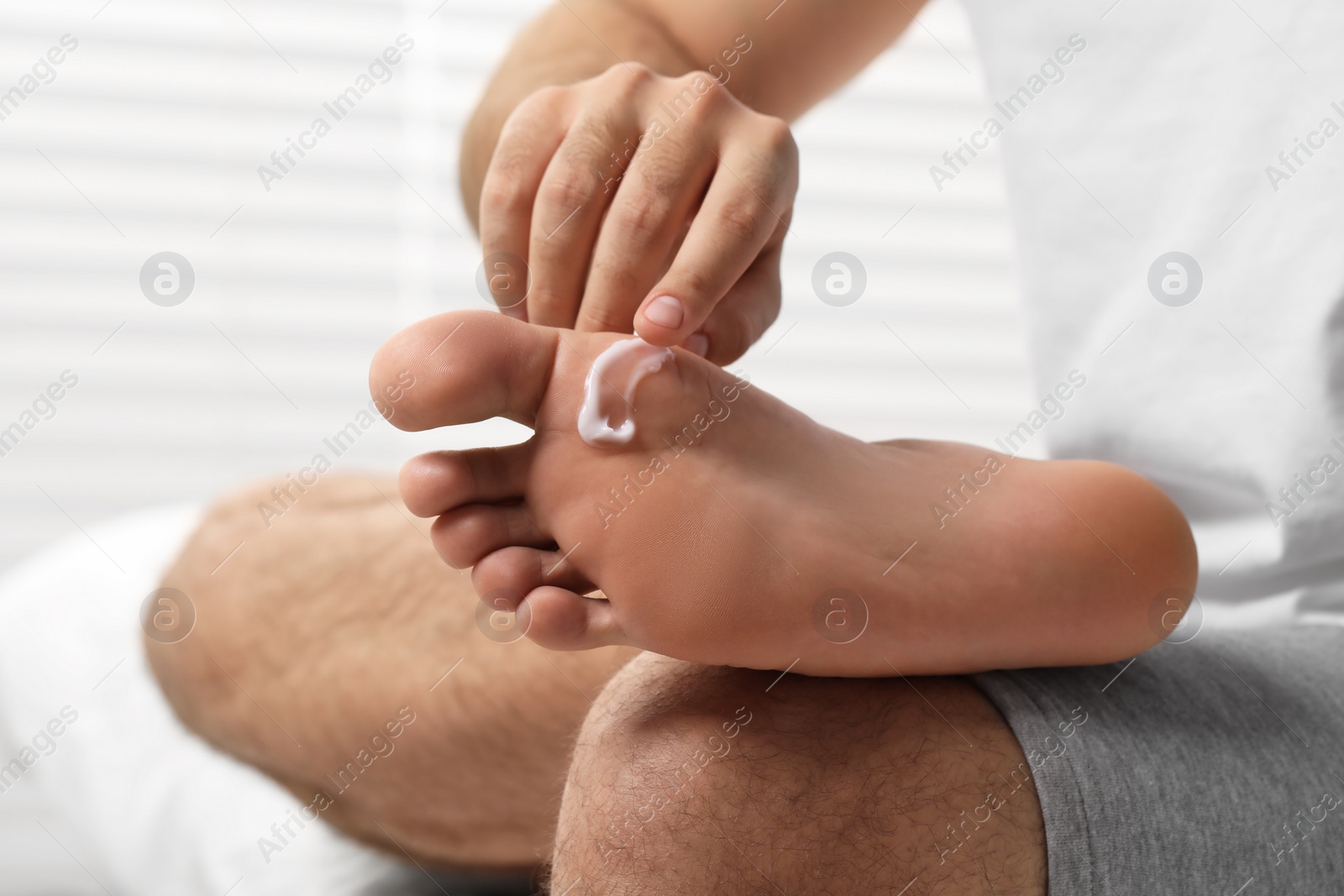 Photo of Man with dry skin applying cream onto his foot on bed, closeup