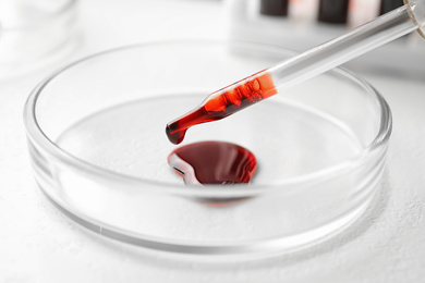 Dripping blood from pipette into Petri dish on table, closeup. Laboratory analysis