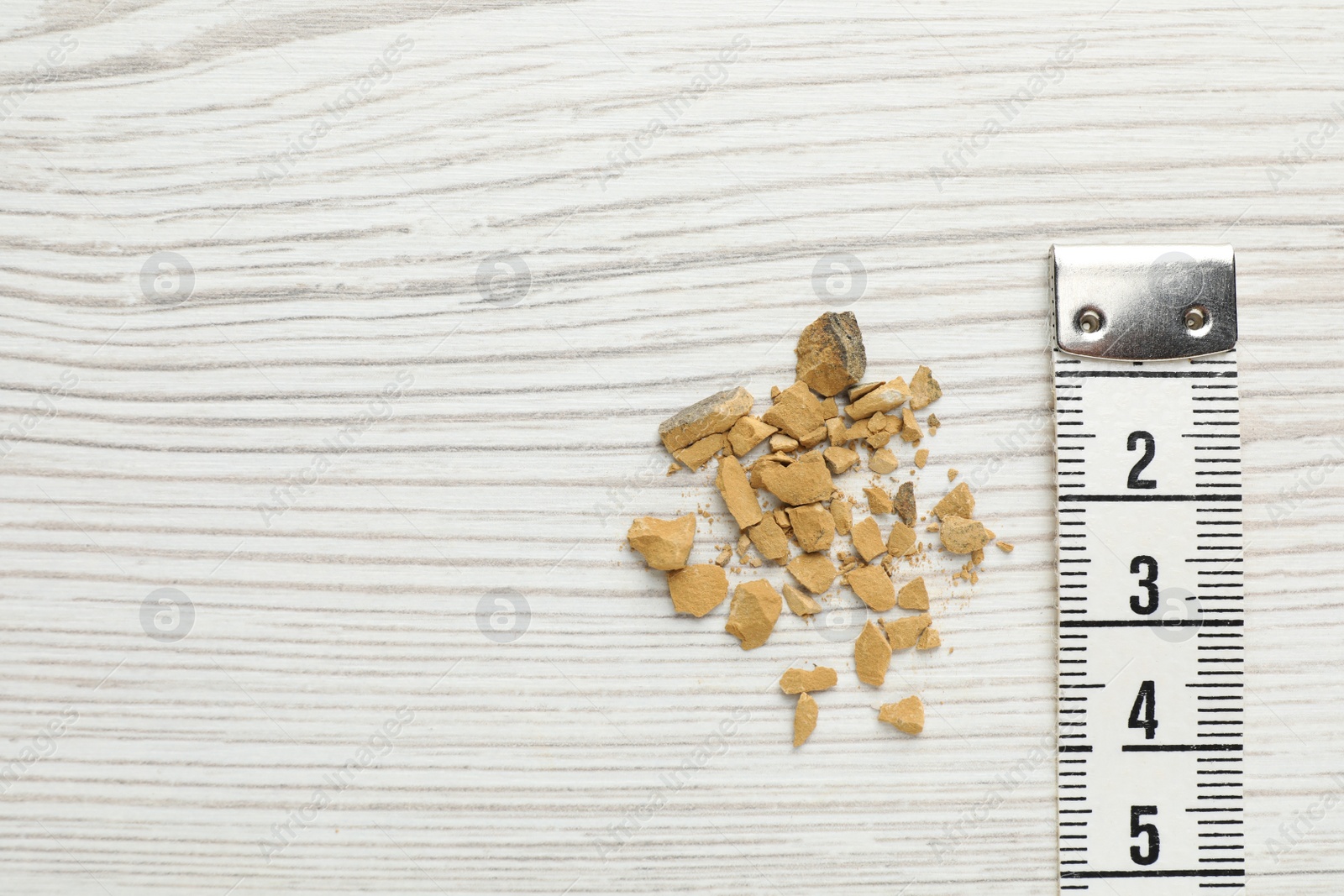Photo of Kidney stones and measuring tape on white wooden table, flat lay. Space for text