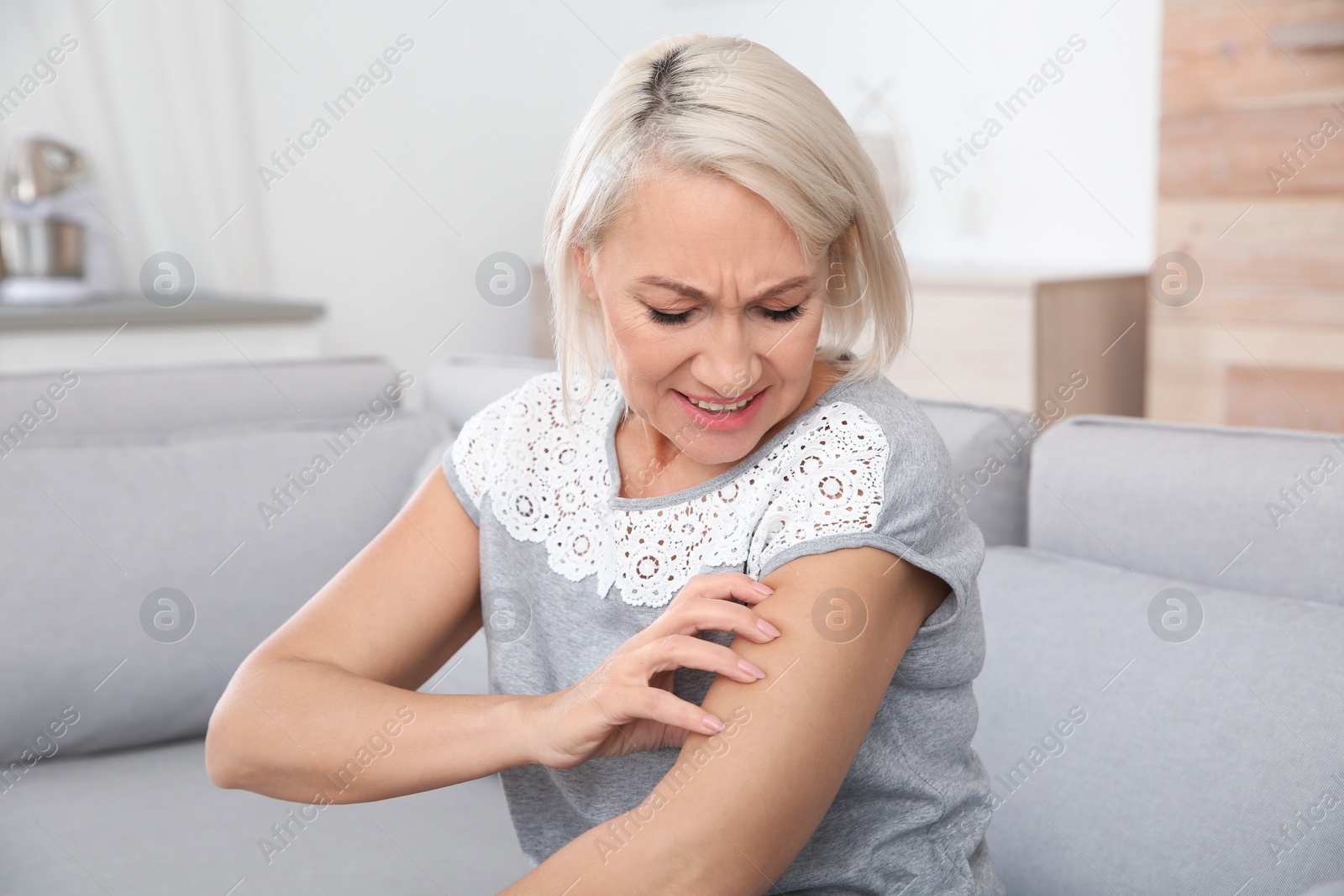 Photo of Mature woman scratching arm at home. Annoying itch