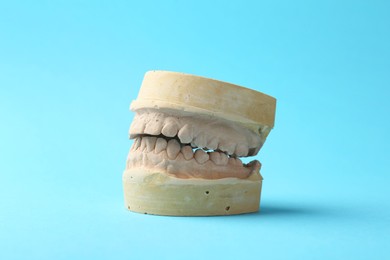 Photo of Dental model with gums on light blue background. Cast of teeth