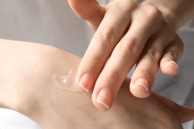 Photo of Woman applying ointment to her hand, closeup