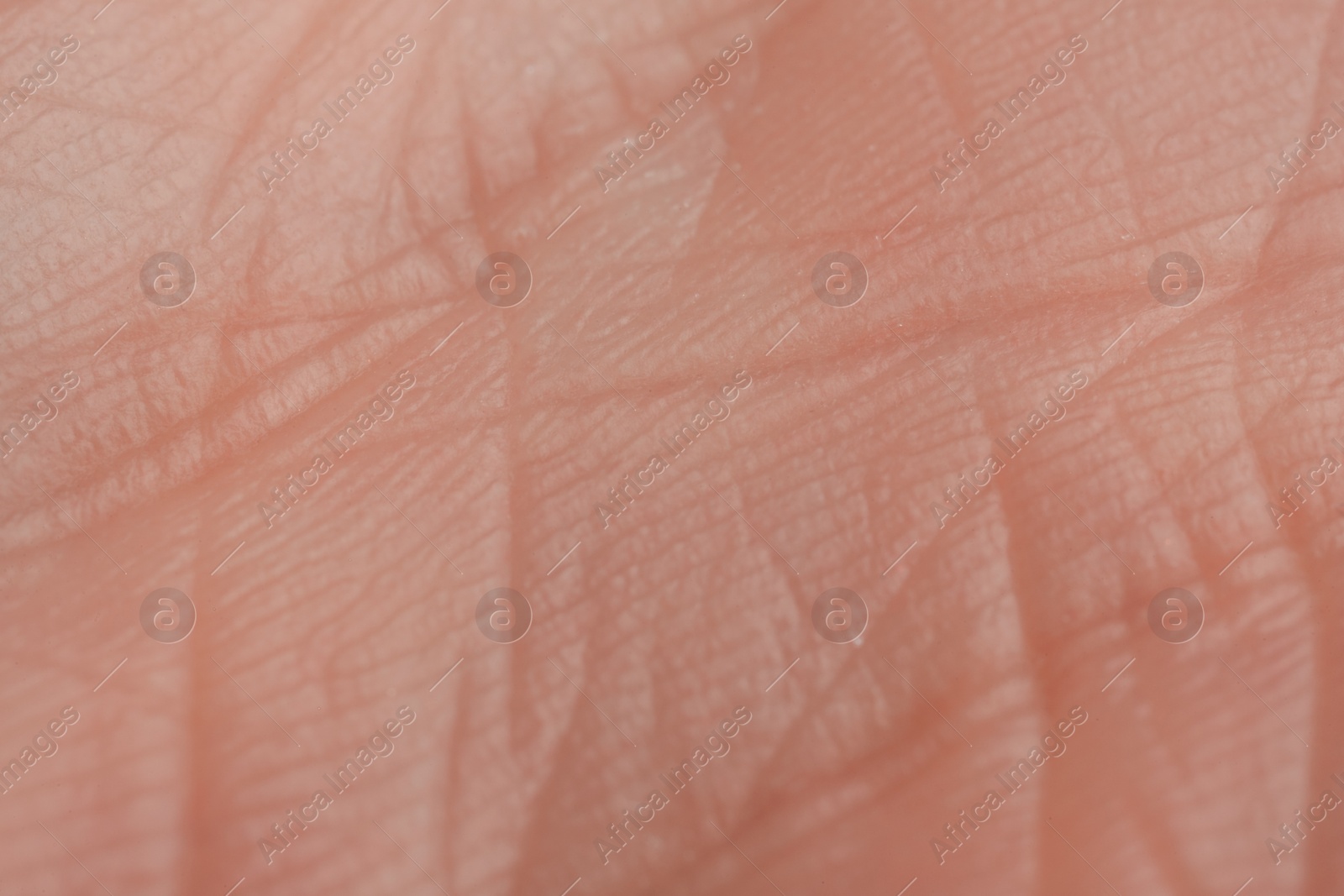 Photo of Texture of dry skin as background, macro view