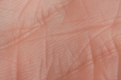 Texture of dry skin as background, macro view