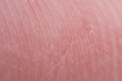 Photo of Skin friction ridges on finger as background, macro view