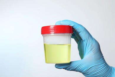 Photo of Doctor holding container with urine sample for analysis on white background, closeup