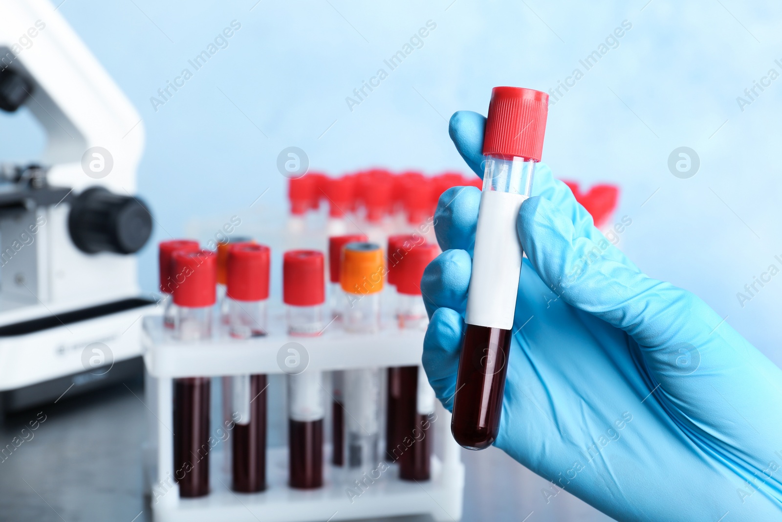 Photo of Doctor holding glass tube with blood in laboratory, closeup. Allergy test